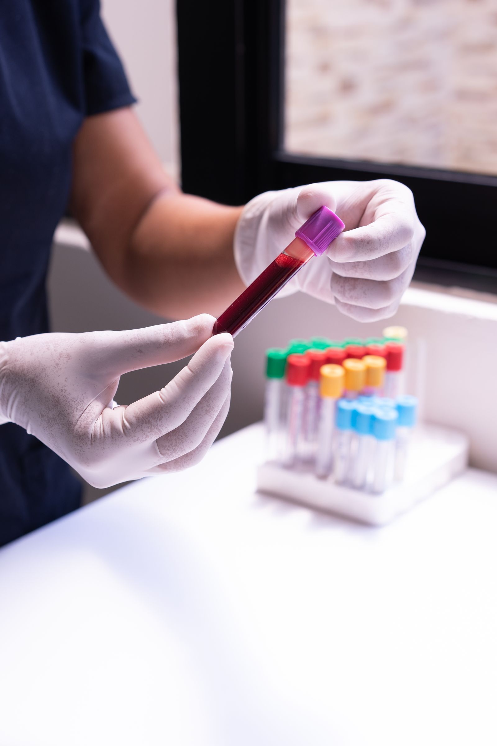 Lab technician holding a blood sample tube labeled for CBC test