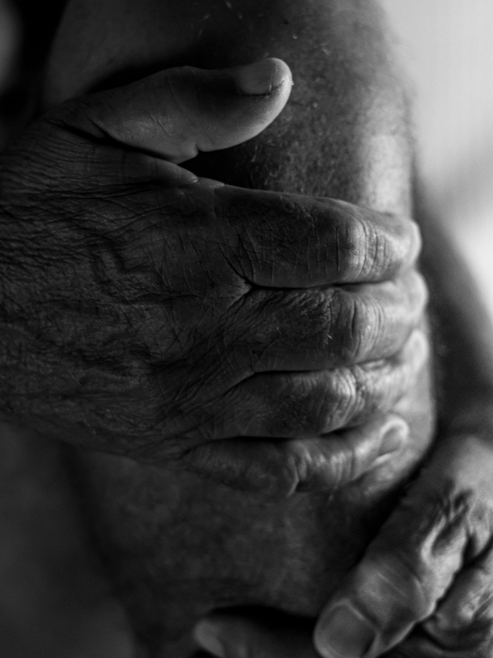 Elderly person holding swollen, painful knee joint with arthritis