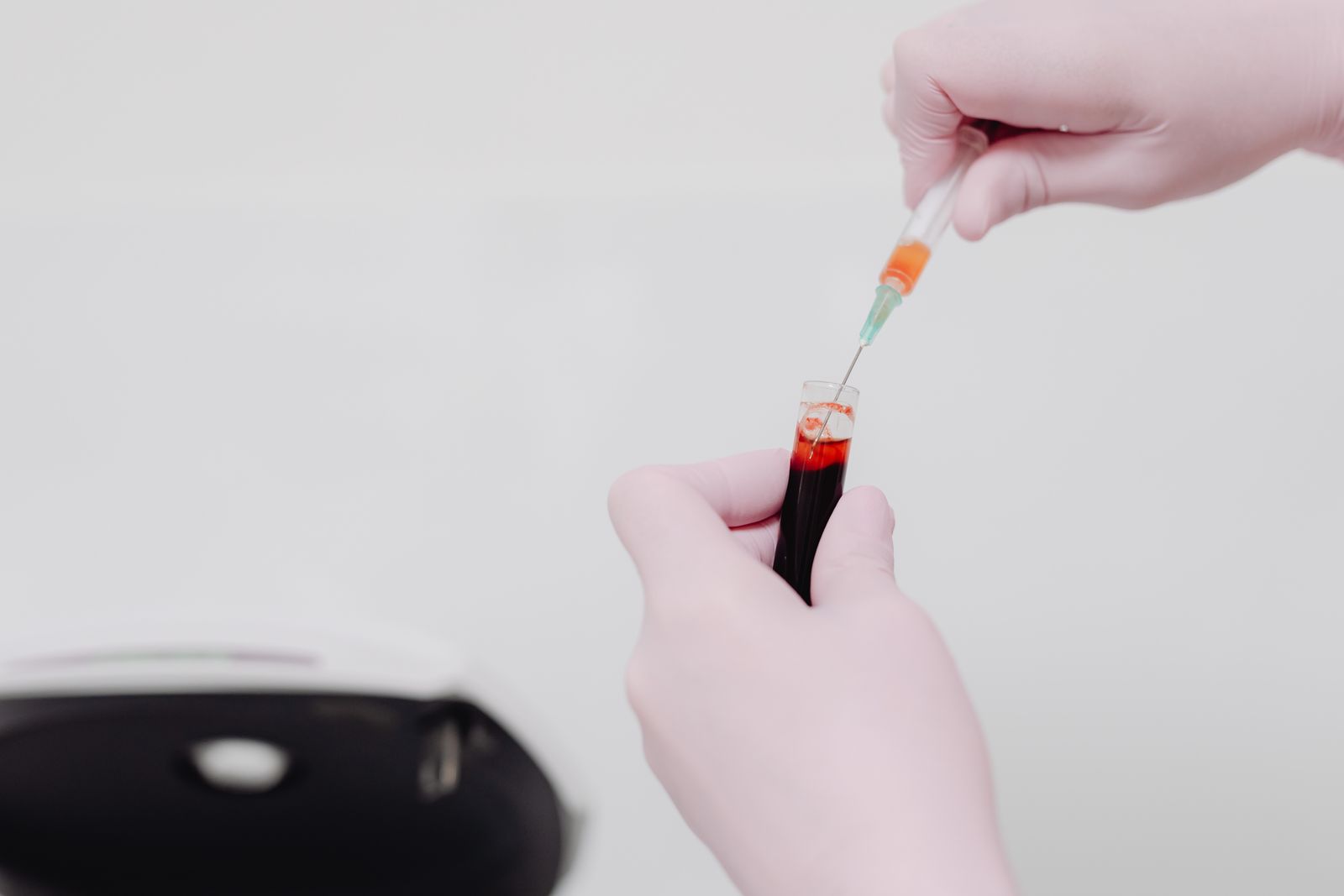 Lab report showing Liver Function Test results with blood sample tube