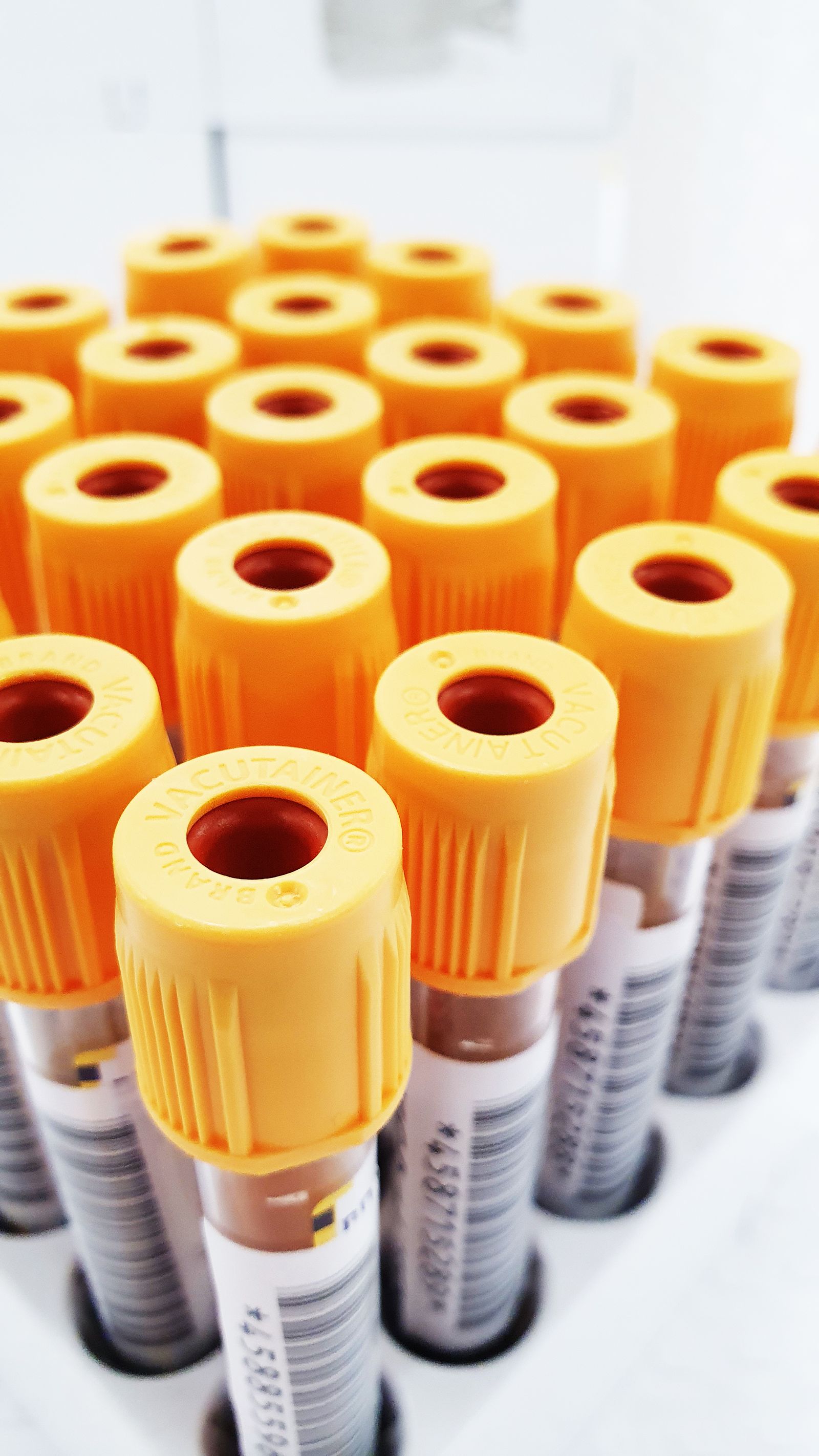 Lab blood sample tube for lipid profile cholesterol test