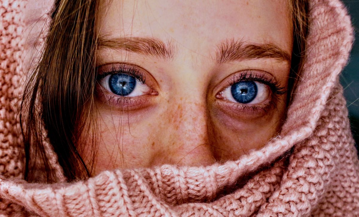 Close-up of eye — conjunctivitis pink eye