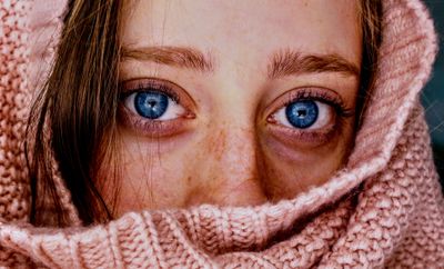 Close up of eye — conjunctivitis pink eye
