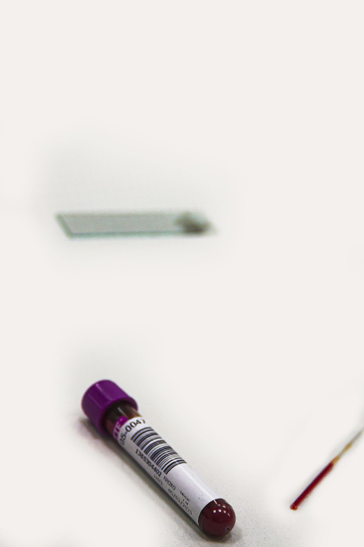 Blood test tubes for anemia diagnosis