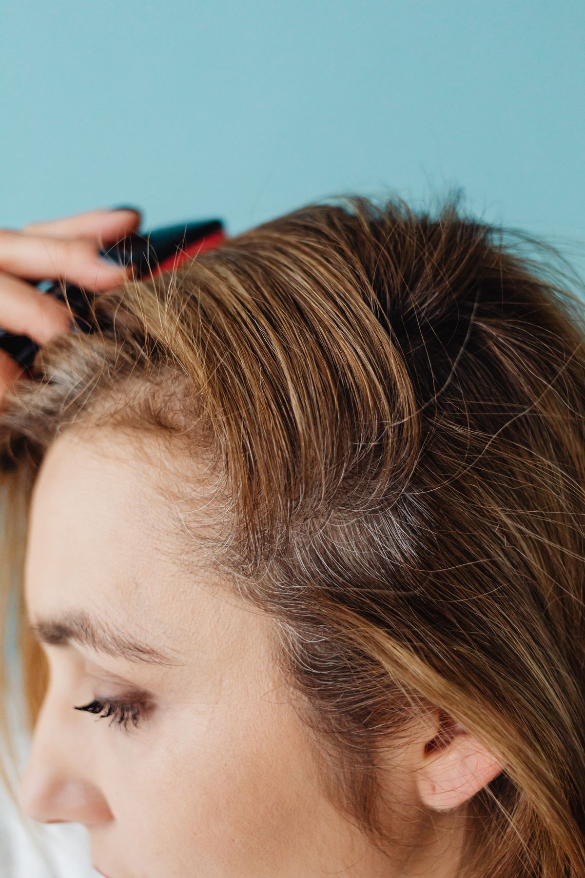Person examining scalp for dandruff