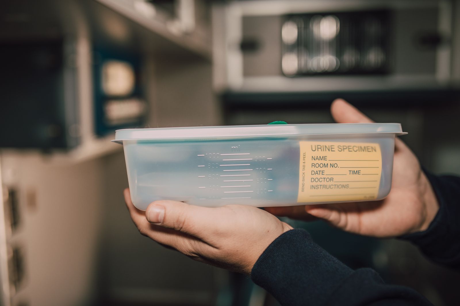 Urine sample cup and dipstick test in laboratory setting